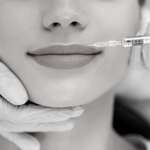 Relleno de labios con ácido hialurónico por el Doctor Oriol Vernetta en la ciudad de Barcelona