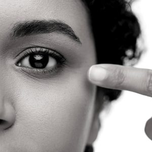 ¿Qué es la blefaroplastia inferior- El Doctor Oriol Vernetta responde en Barcelona