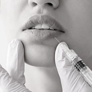 Todo lo que necesitas saber sobre los rellenos de labios gracias al Doctor Oriol Vernetta en la provincia de Barcelona