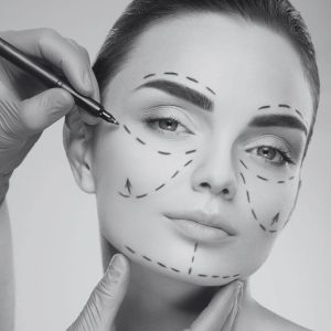 Descubre cómo obtener resultados naturales con cirugía estética en nuestro artículo especializado