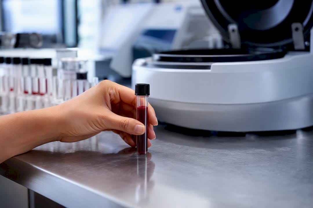 Tubo de muestra de sangre para análisis hormonales
