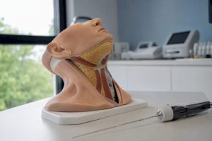 Primer plano de un tratamiento de radiofrecuencia en la zona del cuello de un modelo
