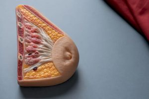 Modelo anatómico que muestra un pezón invertido